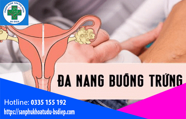 biểu hiện của đa nang buồng trứng