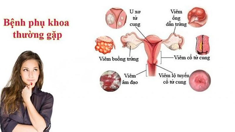 cac-benh-phu-khoa-thuong-gap-1 Các bệnh phụ khoa thường gặp