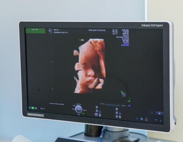 Các mốc siêu âm 4D rất quan trọng