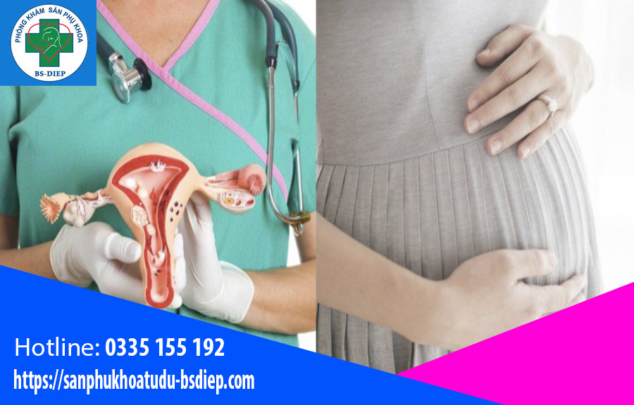 Cách dưỡng thai khi mang thai có u xơ tử cung