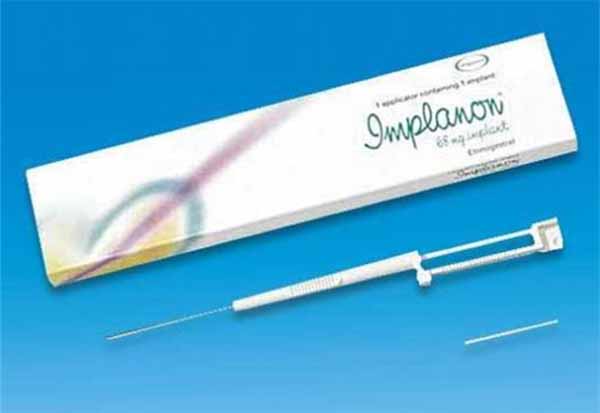 Cấy que ngừa thai