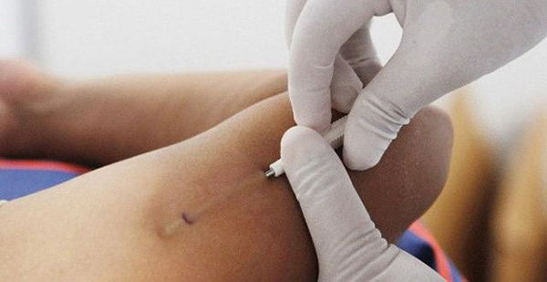 Cấy que tránh thai có tác dụng từ 3-5 năm