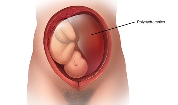 da-oi-tuan-32 Đa ối tuần 32