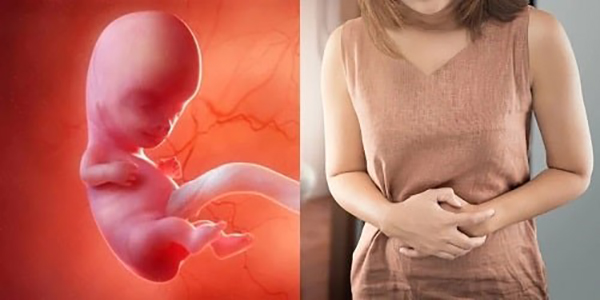 Dấu hiệu nhận biết thai lưu