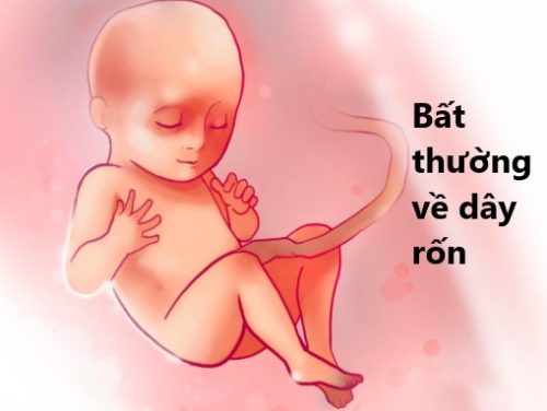 day-ron-bat-thuong Day rốn bất thường
