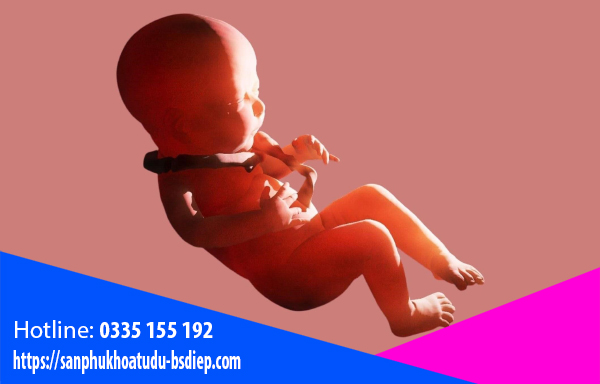 day-ron-quan-co-1-vong-1 Dây rốn quấn cổ 1 vòng