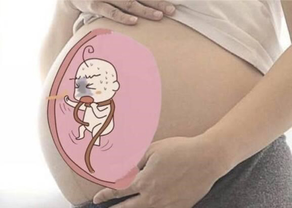 day-ron-quan-co-qua-chat Dây rốn quấn cổ quá chặt