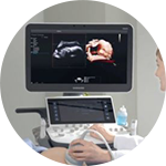 dịch vụ siêu âm