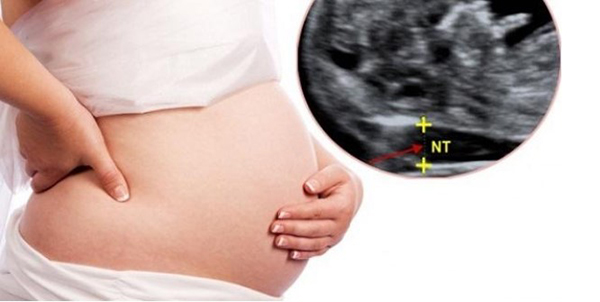 Độ mờ da gáy 1.5 khi thai 12 tuần là bình thường nên mẹ bầu không cần lo lắng