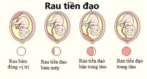 dung-chu-quan-rau-tien-dao Đừng chủ quan rau tiền đạo