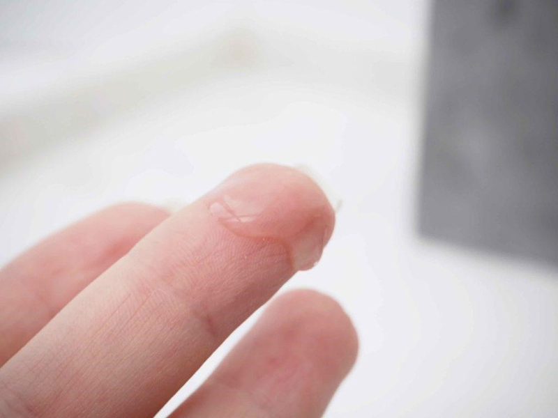 huyet-trang-dac Huyết trắng đặc