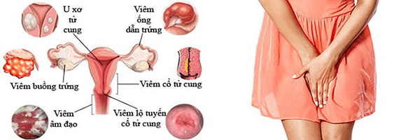 Khám phụ khoa nên lưu ý điều gì?