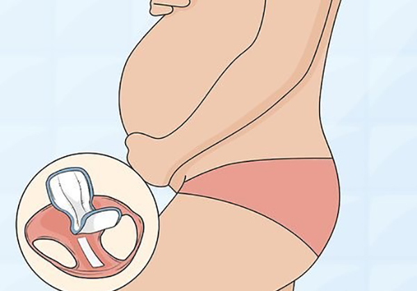 rỉ ối có chảy liên tục không?