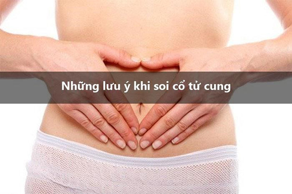 Luu ý khi soi cổ ttu73 cung
