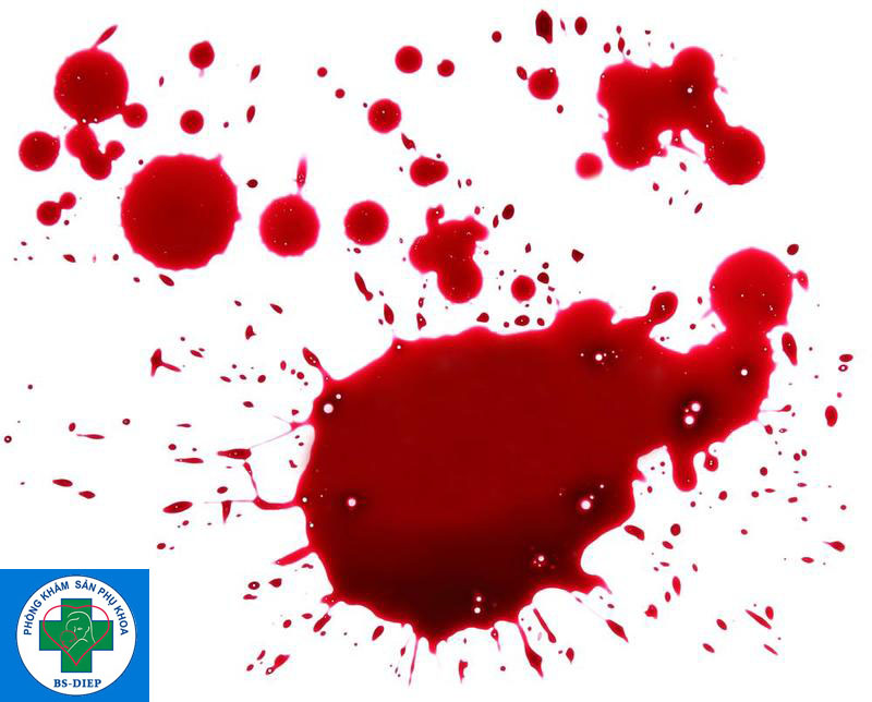 Máu xảy thai có màu gi