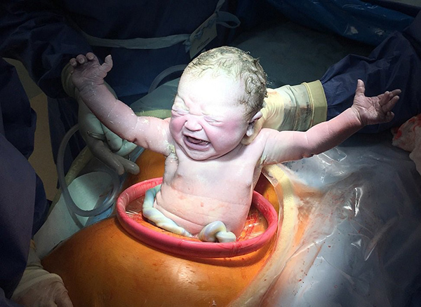 nen-sinh-mo-lan-3 Sinh mổ