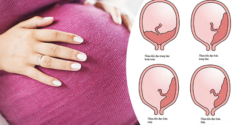 Nhau tiền đạo trung tâm