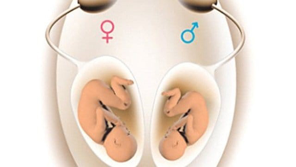 nhung-cau-hoi-lien-quan Những câu hỏi liên quan