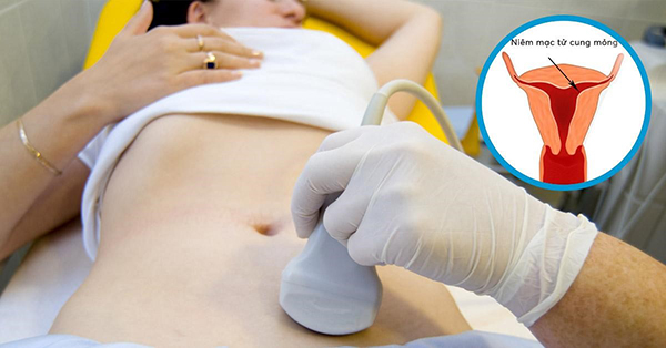 Lớp niêm mạc mỏng cũng có thể là biến chứng của phẫu thuật tử cung