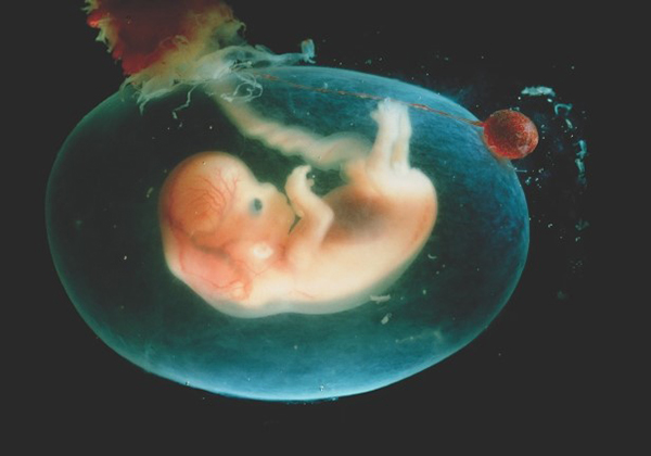 Nước ối bao bọc thai nhi