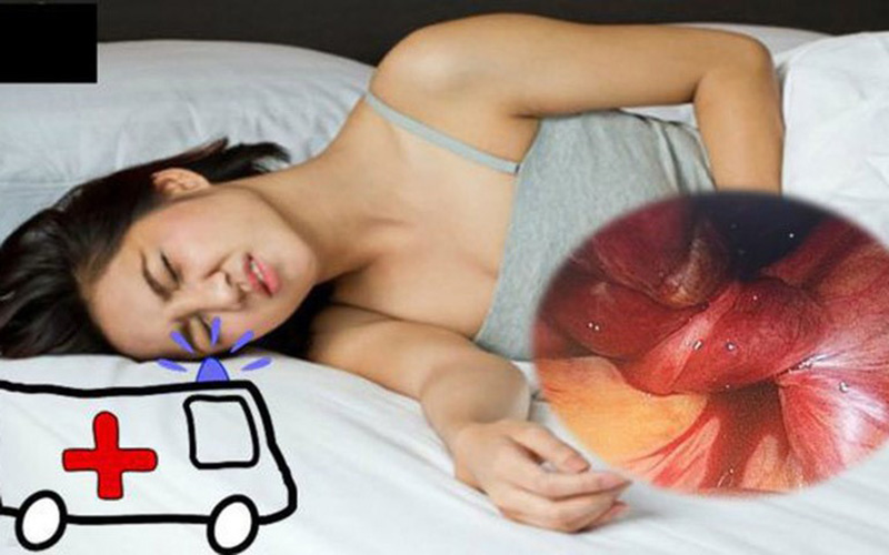 phong-ngua-nang-buong-trung-xoan Phòng ngừa nang buồng trứng xoắn