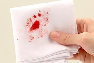 Ra huyết bất thường