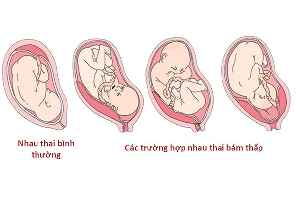 rau-bam-thap Rau bám thấp