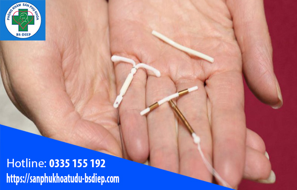 sau-sinh-bao-lau-thi-dat-vong-tranh-thai-duoc sau sinh bao lâu thì đặt vòng được