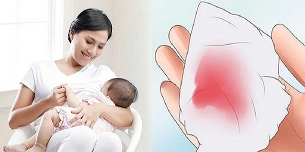 Sau sinh mổ bao lâu thì có kinh lại