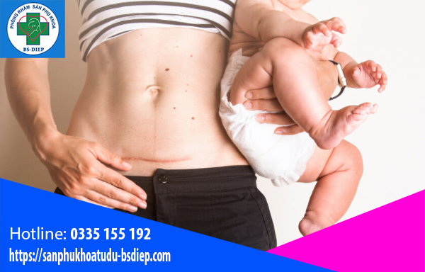 Sau sinh mổ bao lâu thì quan hệ được