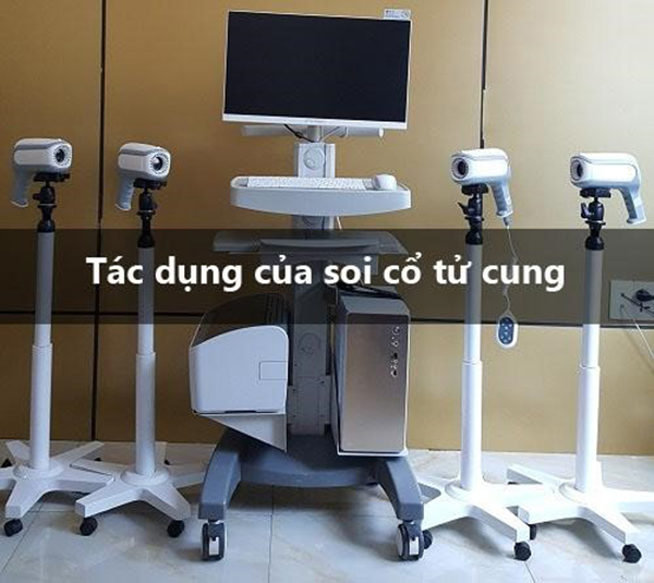Tác dụng của soi cổ tử cung