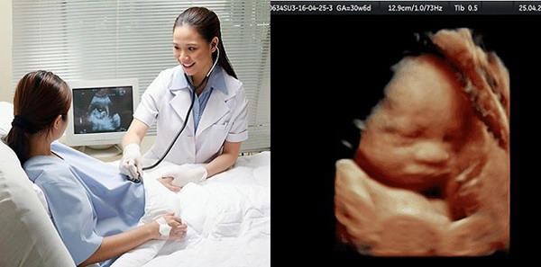 Tăng lịch khám thai