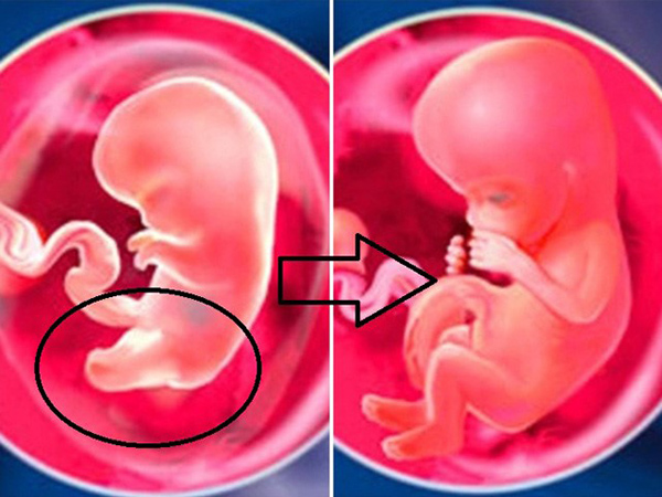 thai-nhi-thang-thu-3 Thai nhi tháng thứ 3