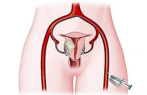 Bạn có thể đẩy lùi bệnh thông qua việc tiêm thuốc