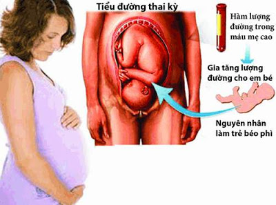 Phụ nữ trong thời kỳ mang thai dễ bị tiểu đường
