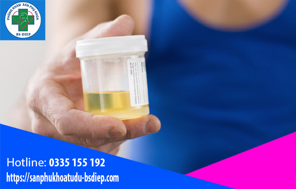 Tổng phân tích nước tiểu