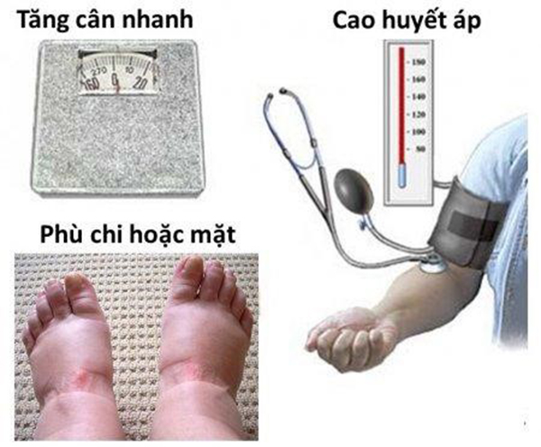 Triệu chứng tiền sản giật