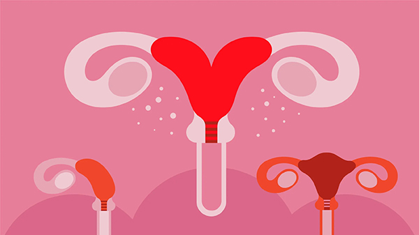 tu-cung-bat-thuong Tử ung bất thường