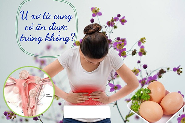Bị u xơ tử cung có được ăn trứng không?