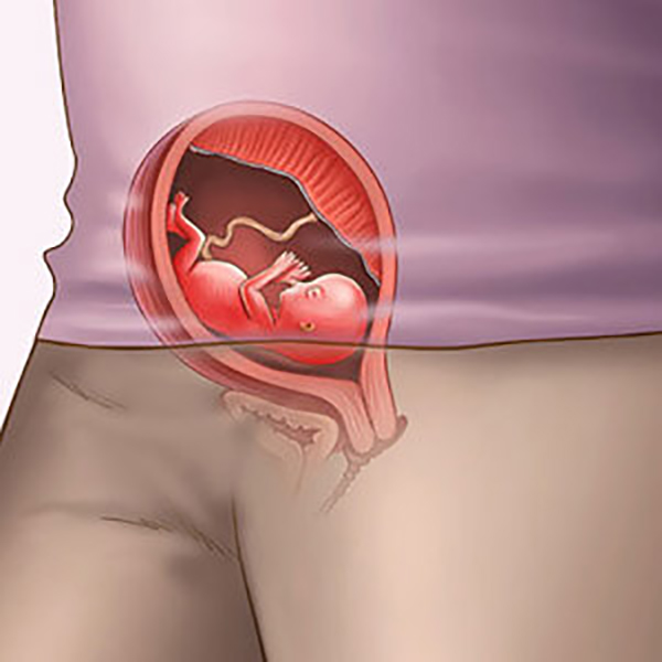 vi-tri-thai-nhi-tro-ngbung-me-3-thang-dau Vị trí thai nhi trong bụng mẹ 3 tháng đầu không ngừng thay đổi