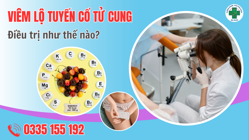 điều trị viêm lộ tuyến