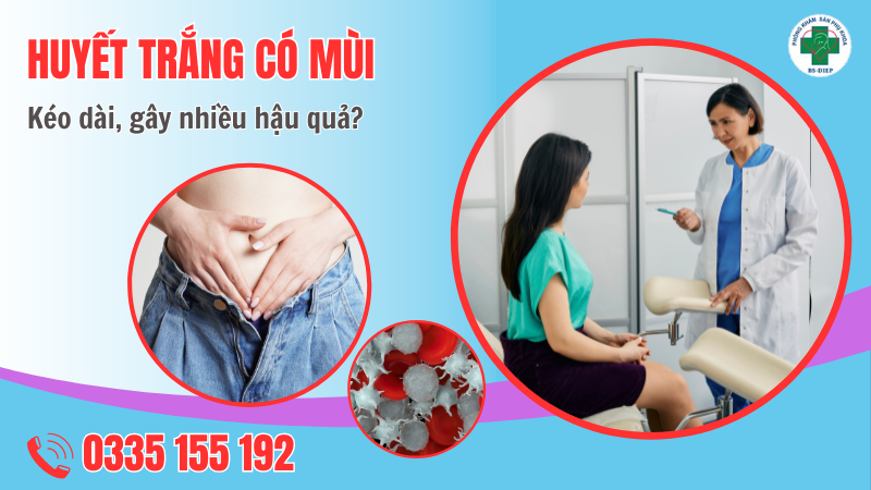 huyết trắng có mùi